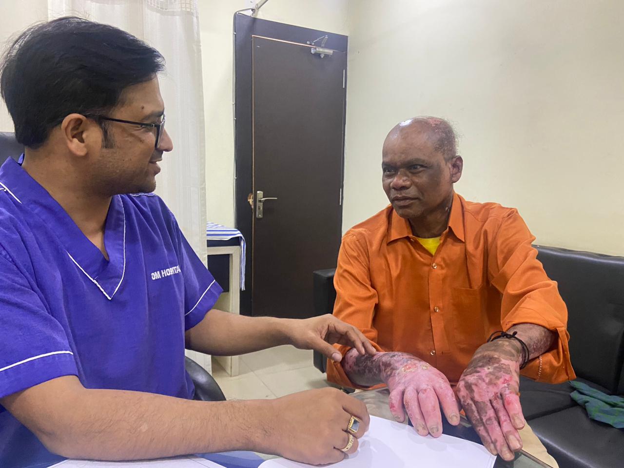 80% जला मरीज हुआ स्वस्थ्य, ओम हॉस्पिटल में ईएसआईसी से हुआ 20 लाख का फ्री इलाज