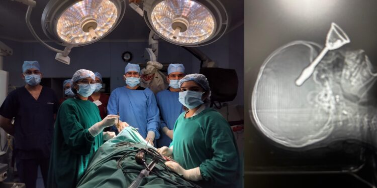 छत्तीसगढ़ः खेलते वक्त घंटी आंख से होते दिमाग में घुसी, डॉक्टरों ने दिया नया जीवन