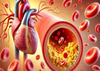 सावधान! बिना डॉक्टर की सलाह के कोलेस्ट्रॉल घटाना पड़ सकता है भारी, नपुंसकता और बांझपन का बढ़ रहा है खतरा